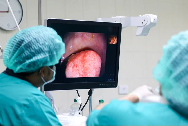 Colonoscopy
