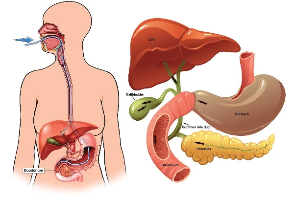 ERCP